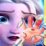 Elsa Hand Doctor – Fun Games for Girls Online
